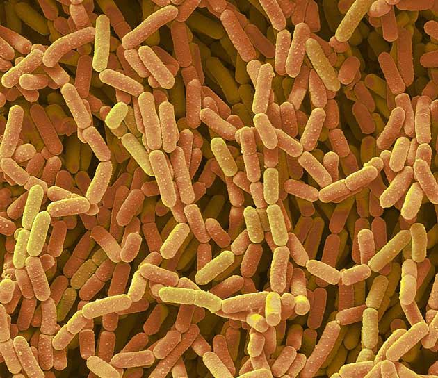  Lactobacillus rhamnosus 