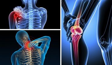 Bệnh đau xương khớp gây ảnh hưởng nghiêm trọng đến chất lượng cuộc sống