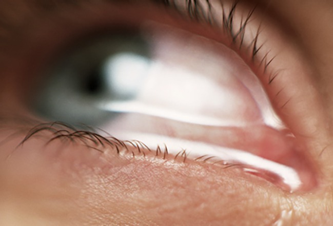 Dấu hiệu bệnh ung thư mắt ở người lớn
