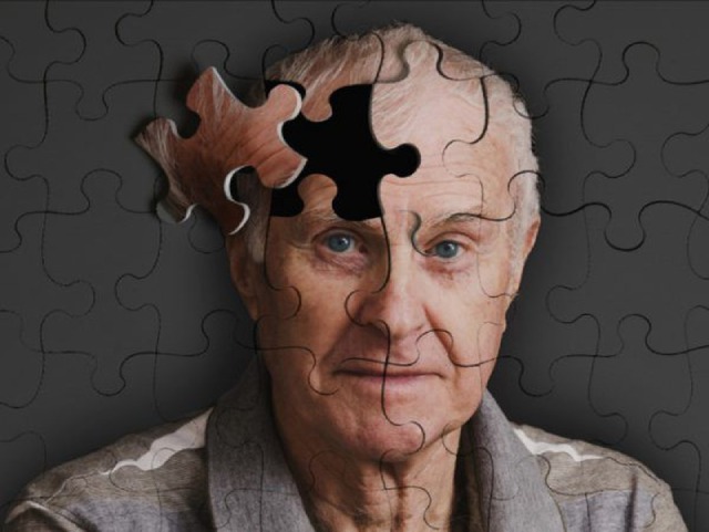 Đối tượng có khả năng mắc bệnh Alzheimer