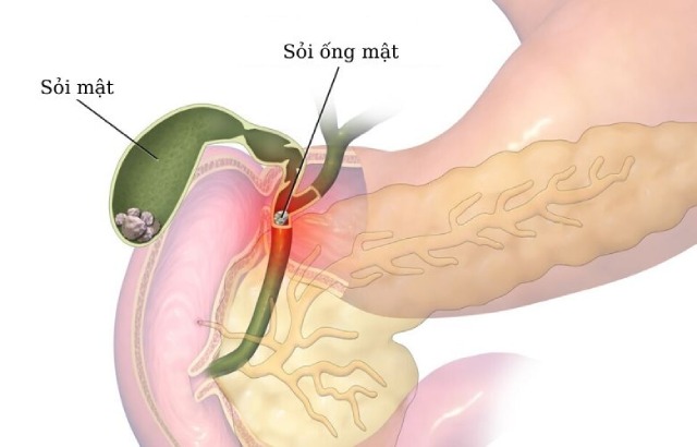 Ống mật chủ