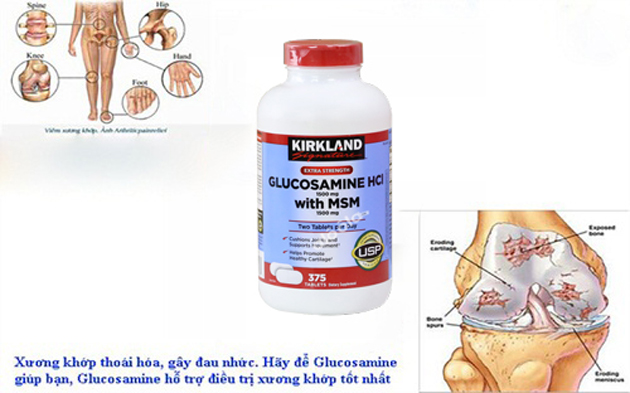 Một số lưu ý khi sử dụng Glucosamine