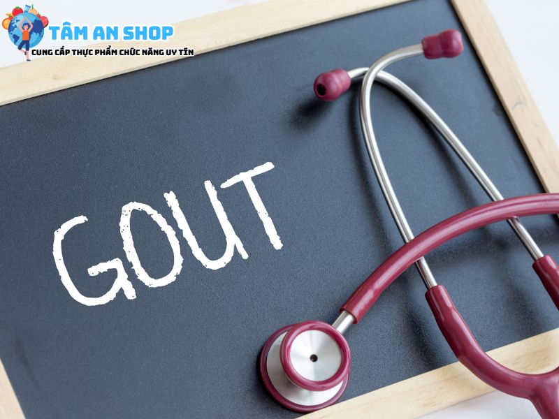 Cách điều trị bệnh Gout