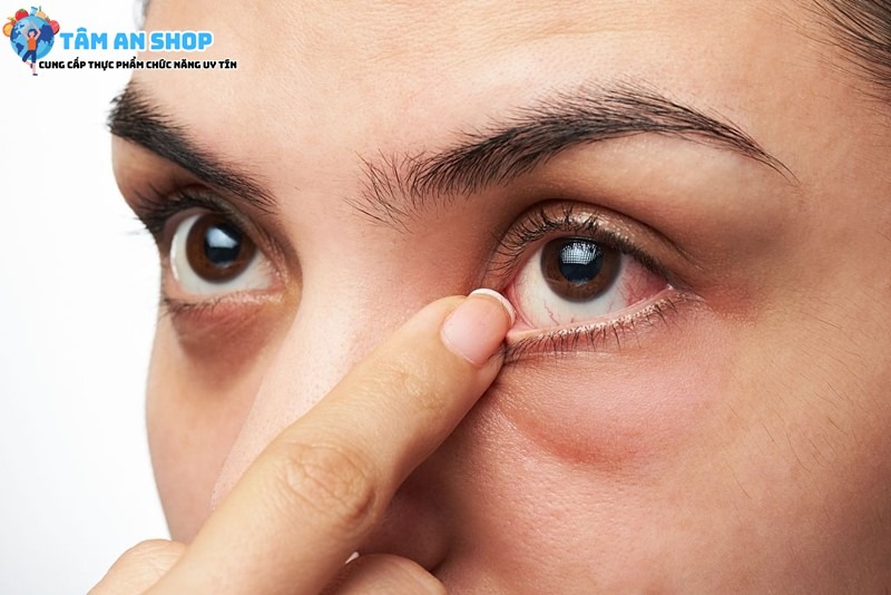 Dấu hiệu nhận biết ung thư mắt ở người lớn