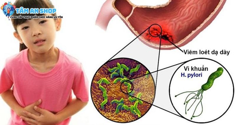 Nhiễm vi khuẩn Hp khi còn nhỏ