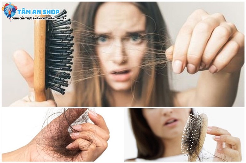 Tìm hiểu những nguyên nhân dẫn đến rụng tóc