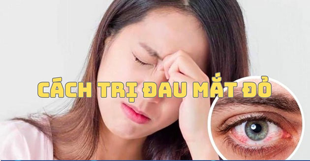 Cách trị đau mắt đỏ