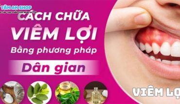 Viêm lợi